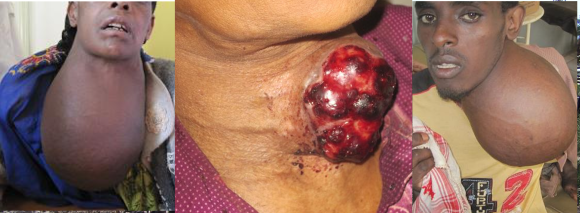 thyroid collage copy