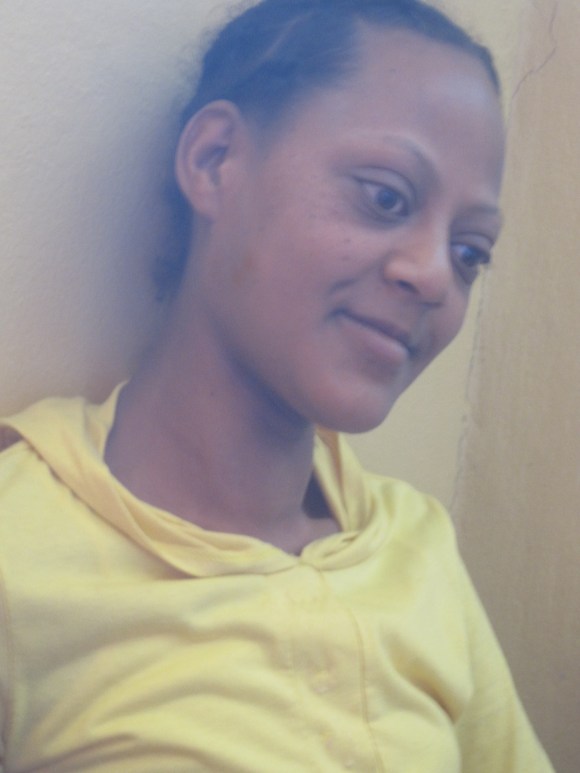 thyroid exophth copy